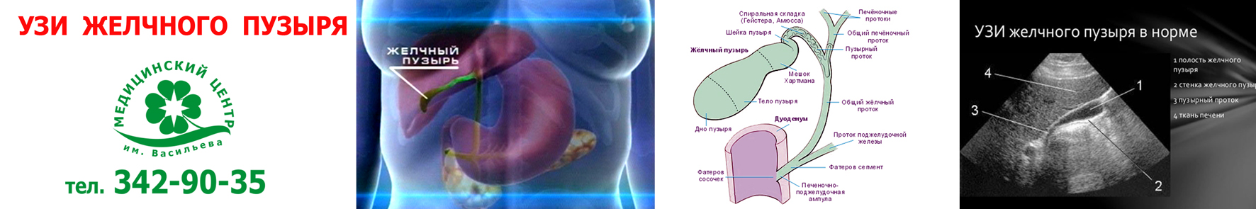 Желчный пузырь строение анатомия УЗИ